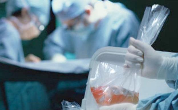 Imagen de un órgano a punto de ser transplantado./